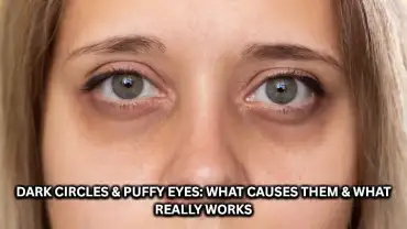 DARK CIRCLES & PUFFY EYES: WHAT CAUSES THEM AND WHAT REALLY WORKS