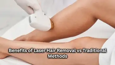 Benefits of Laser Hair Removal vs Traditional Methods